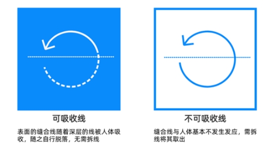 可吸收缝合线与非可吸收缝合线.jpeg